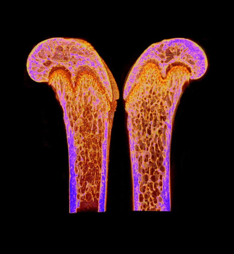 Svolta nella salute delle ossa: scoperto ormone che le rende superforti Futuro Prossimo