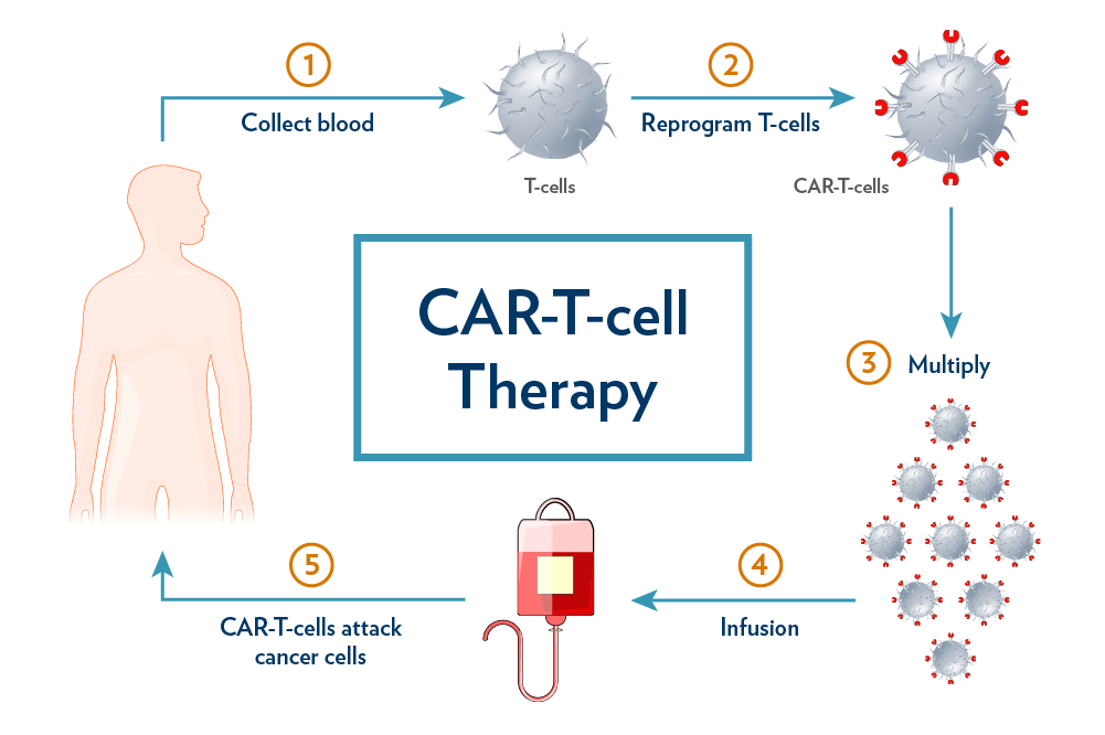 La terapia CAR-T contro tumori solidi: i nuovi sviluppi Futuro Prossimo