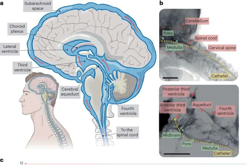 ECI, interfaccia neurale che cura il cervello senza aprire il cranio Futuro Prossimo